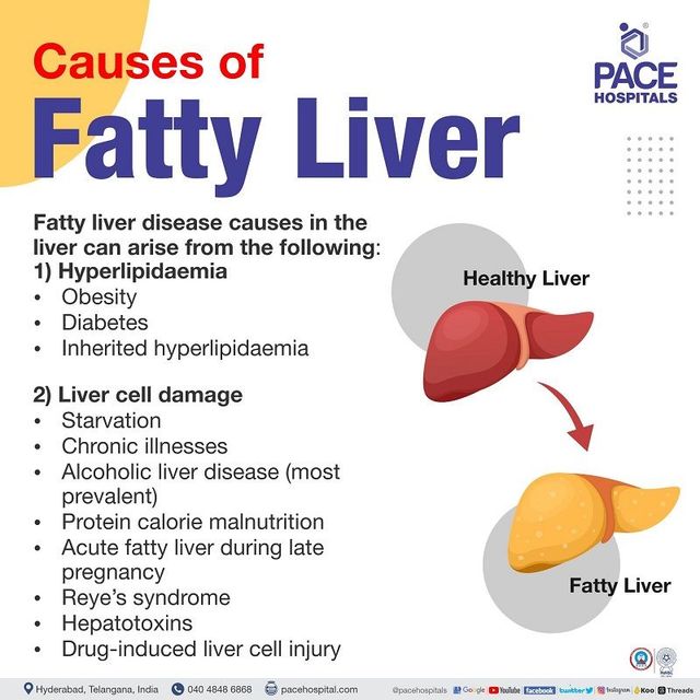 Fatty Liver Symptoms, Grade, Causes, Complications, Prevention